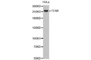 Western Blotting (WB) image for anti-Filamin B, beta (FLNB) (AA 1686-1785) antibody (ABIN1679857) (FLNB Antikörper  (AA 1686-1785))