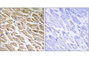 Immunohistochemistry analysis of paraffin-embedded human heart tissue, using MRPL39 Antibody. (MRPL39 Antikörper  (AA 289-338))