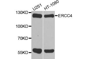 Western blot analysis of extracts of various cell lines, using ERCC4 antibody. (ERCC4 Antikörper)