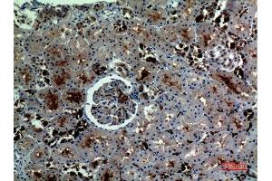 Immunohistochemistry (IHC) analysis of paraffin-embedded Human Kidney, antibody was diluted at 1:100. (Catalase Antikörper  (C-Term))