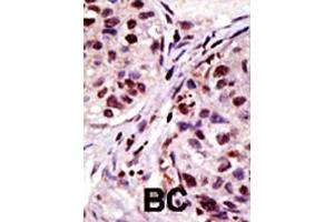 Immunohistochemistry (Paraffin-embedded Sections) (IHC (p)) image for anti-Hepatocyte Growth Factor-Regulated tyrosine Kinase Substrate (HGS) (AA 256-286), (N-Term) antibody (ABIN388936)