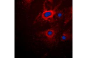 Immunofluorescent analysis of Cytokeratin 8 staining in HeLa cells. (KRT8 Antikörper  (C-Term))