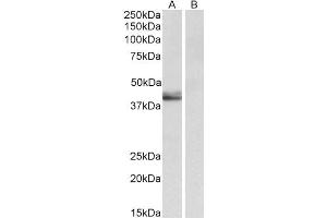 Western Blotting (WB) image for anti-serpin Peptidase Inhibitor, Clade B (Ovalbumin), Member 1 (SERPINB1) (AA 130-143) antibody (ABIN1782172)