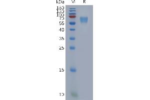 Human AM Protein, His Tag on SDS-PAGE under reducing condition.