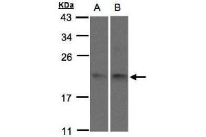 WB Image Sample(30 μg of whole cell lysate) A:293T B:H1299 15% SDS PAGE antibody diluted at 1:1500