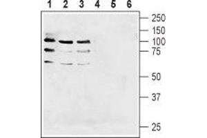 Western blot analysis of human  breast adenocarcinoma cell lysate (lanes 1 and 4), human U87-MG glioblastoma cell lysate (lanes 2 and 5) and human  breast adenocarcinoma cell lysate  (lanes 3 and 6):1-3. (Neuregulin 1 (NRG1) Peptid)