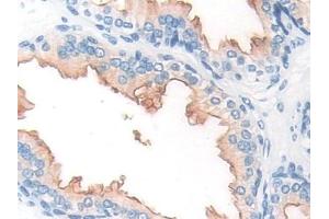 Detection of PMSA in Human Prostate Tissue using Polyclonal Antibody to Prostate-specific Membrane Antigen (PMSA) (PSMA Antikörper  (AA 274-587))