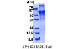 Figure annotation denotes ug of protein loaded and % gel used. (LCAT Protein)