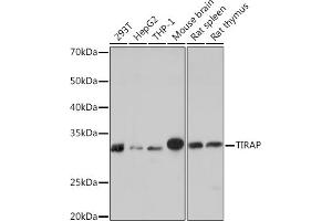 Western blot analysis of extracts of various cell lines, using TIRAP Rabbit mAb (ABIN7270842) at 1:1000 dilution. (TIRAP Antikörper)