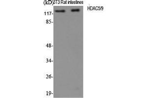Western Blot (WB) analysis of specific cells using HDAC5/9 Polyclonal Antibody. (HDAC5/9 (Ser1177) Antikörper)