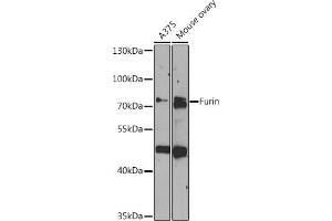Western blot analysis of extracts of various cell lines, using Furin antibody (ABIN6127932, ABIN6140814, ABIN6140816 and ABIN6217288) at 1:1000 dilution. (FURIN Antikörper  (AA 120-370))
