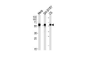 Western blot analysis in Hela,SH-SY5Y,rat C6 cell line lysates (35ug/lane).