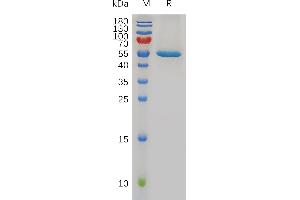 SDS-PAGE (SDS) image for Fibroblast Growth Factor 21 (FGF21) (AA 29-209) protein (Fc Tag) (ABIN7491006)