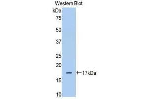 Western Blotting (WB) image for anti-Complement Factor B (CFB) (AA 477-600) antibody (ABIN1858375) (Complement Factor B Antikörper  (AA 477-600))