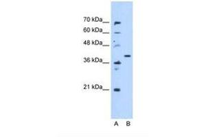 ECHDC3 Antikörper  (AA 71-120)