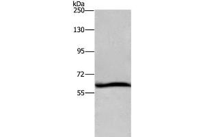 Western Blot analysis of Hela cell using DCP1A Polyclonal Antibody at dilution of 1:1100 (DCP1A Antikörper)