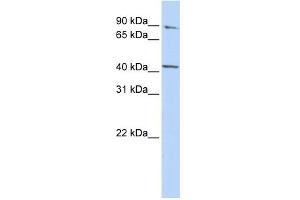 WB Suggested Anti-FECH Antibody Titration:  0. (FECH Antikörper  (Middle Region))