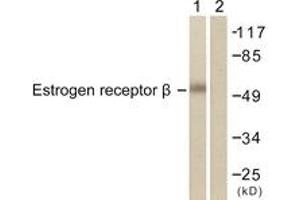 Western blot analysis of extracts from HeLa cells, treated with EGF 200ng/ml 30', using Estrogen Receptor-beta (Ab-105) Antibody. (ESR2 Antikörper  (AA 71-120))
