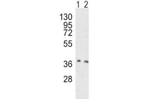 Western blot analysis of OGG1 antibody and human HeLa (lane 1), mouse NIH3T3 (2) lysate (OGG1 Antikörper  (AA 318-345))