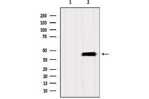 Western blot analysis of extracts from Mouse brain, using ASBT Antibody.