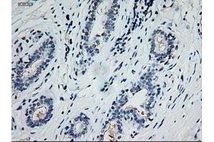 Immunohistochemical staining of paraffin-embedded breast using anti-EpCAM (ABIN2452677) mouse monoclonal antibody. (EpCAM Antikörper  (AA 24-265))