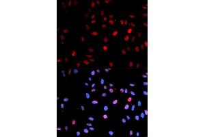 Immunofluorescence (IF) image for anti-Tumor Protein P53 (TP53) (pSer15) antibody (ABIN3023601) (p53 Antikörper  (pSer15))