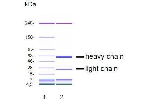 CGE analysis of purified DP-4A1 monoclonal antibody. (EGFR Antikörper)