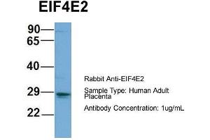 Host: Rabbit  Target Name: EIF4E2  Sample Tissue: Human Adult Placenta  Antibody Dilution: 1. (EIF4E2 Antikörper  (N-Term))