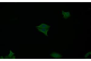Detection of CASP7 in Human MCF7 cell using Polyclonal Antibody to Caspase 7 (CASP7)