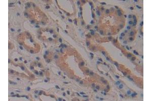 Immunohistochemistry (IHC) image for anti-P21-Activated Kinase 2 (PAK2) (AA 177-419) antibody (ABIN1869664)