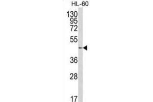 Western Blotting (WB) image for anti-UDP-Gal:betaGlcNAc beta 1,4 Galactosyltransferase, Polypeptide 1 (B4GALT1) antibody (ABIN3003951) (B4GALT1 Antikörper)