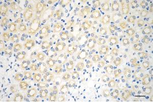 anti-Dynamin 2 (DNM2) antibody