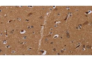 Immunohistochemistry of paraffin-embedded Human brain using MOB1A Polyclonal Antibody at dilution of 1:30 (MOB1A Antikörper)