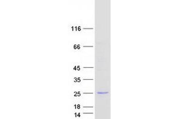 Ureidoimidazoline (2-Oxo-4-Hydroxy-4-Carboxy-5-) Decarboxylase (URAD) protein (Myc-DYKDDDDK Tag)