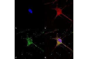 Immunocytochemistry/Immunofluorescence analysis using Mouse Anti-SUR1 Monoclonal Antibody, Clone S289-16 (ABIN2482988). (ABCC8 Antikörper  (AA 1548-1582) (Atto 594))