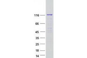 Western Blotting (WB) image for Importin 4 (IPO4) protein (Myc-DYKDDDDK Tag) (ABIN2730458)