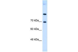 WB Suggested Anti-SLC7A4 Antibody Titration:  0. (SLC7A4 Antikörper  (Middle Region))