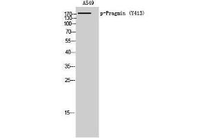 Western Blotting (WB) image for anti-Tyrosine-Protein Kinase SgK223 (SGK223) (pTyr413) antibody (ABIN3172968) (PRAGMIN Antikörper  (pTyr413))