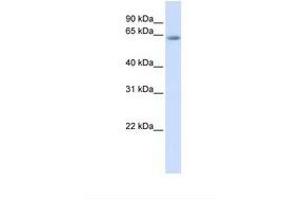 Image no. 1 for anti-Transcription Factor 7-Like 2 (T-Cell Specific, HMG-Box) (TCF7L2) (AA 251-300) antibody (ABIN6737719)