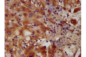 IHC image of ABIN7163270 diluted at 1:400 and staining in paraffin-embedded human liver tissue performed on a Leica BondTM system. (PACS2 Antikörper  (AA 268-465))