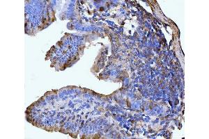 IHC analysis of GLUL using anti-GLUL antibody (ABIN7602403). (GLUL Antikörper  (AA 74-373))