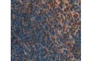 Used in DAB staining on fromalin fixed paraffin- embedded Kidney tissue (DC-SIGN/CD209 Antikörper  (AA 115-238))