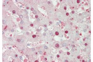 Immunohistochemistry with Liver cell lysate tissue (ATOH1 Antikörper  (Middle Region))