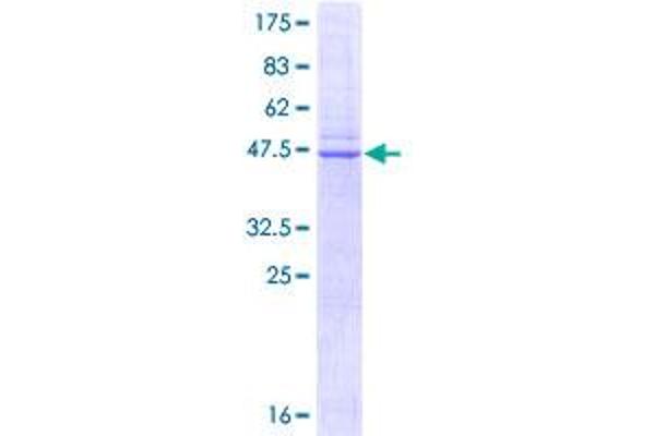 Caveolin-1 Protein (AA 1-178) (GST tag)