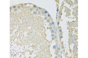 Immunohistochemistry of paraffin-embedded Rat testis using SLC2A9 Polyclonal Antibody at dilution of 1:100 (40x lens). (SLC2A9 Antikörper)