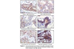 Image no. 1 for anti-Insulin-Like Growth Factor 1 Receptor (IGF1R) antibody (ABIN232138) (IGF1R Antikörper)