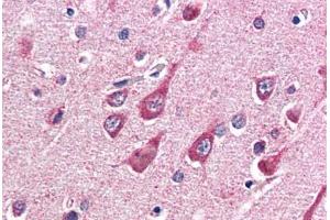 Human Brain, Cortex (formalin-fixed, paraffin-embedded) stained with OGT antibody ABIN337257 at 5 ug/ml followed by biotinylated anti-goat IgG secondary antibody ABIN481715, alkaline phosphatase-streptavidin and chromogen. (OGT Antikörper  (AA 543-555))