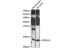 Western blot analysis of extracts of various cell lines, using TPD52L3 antibody. (TPD52L3 Antikörper)