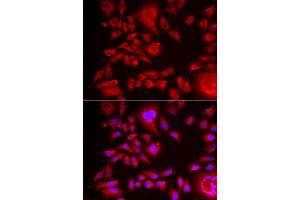 Immunofluorescence analysis of HeLa cells using BLMH antibody (ABIN6127522, ABIN6137574, ABIN6137575 and ABIN6222197). (BLMH Antikörper  (AA 1-300))