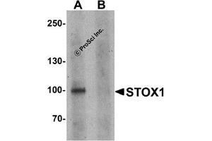Western Blotting (WB) image for anti-Storkhead Box 1 (STOX1) (C-Term) antibody (ABIN1030709) (STOX1 Antikörper  (C-Term))